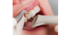 Na czym polega skaling zębów i czy warto usuwać kamień nazębny przy pomocy tej metody?