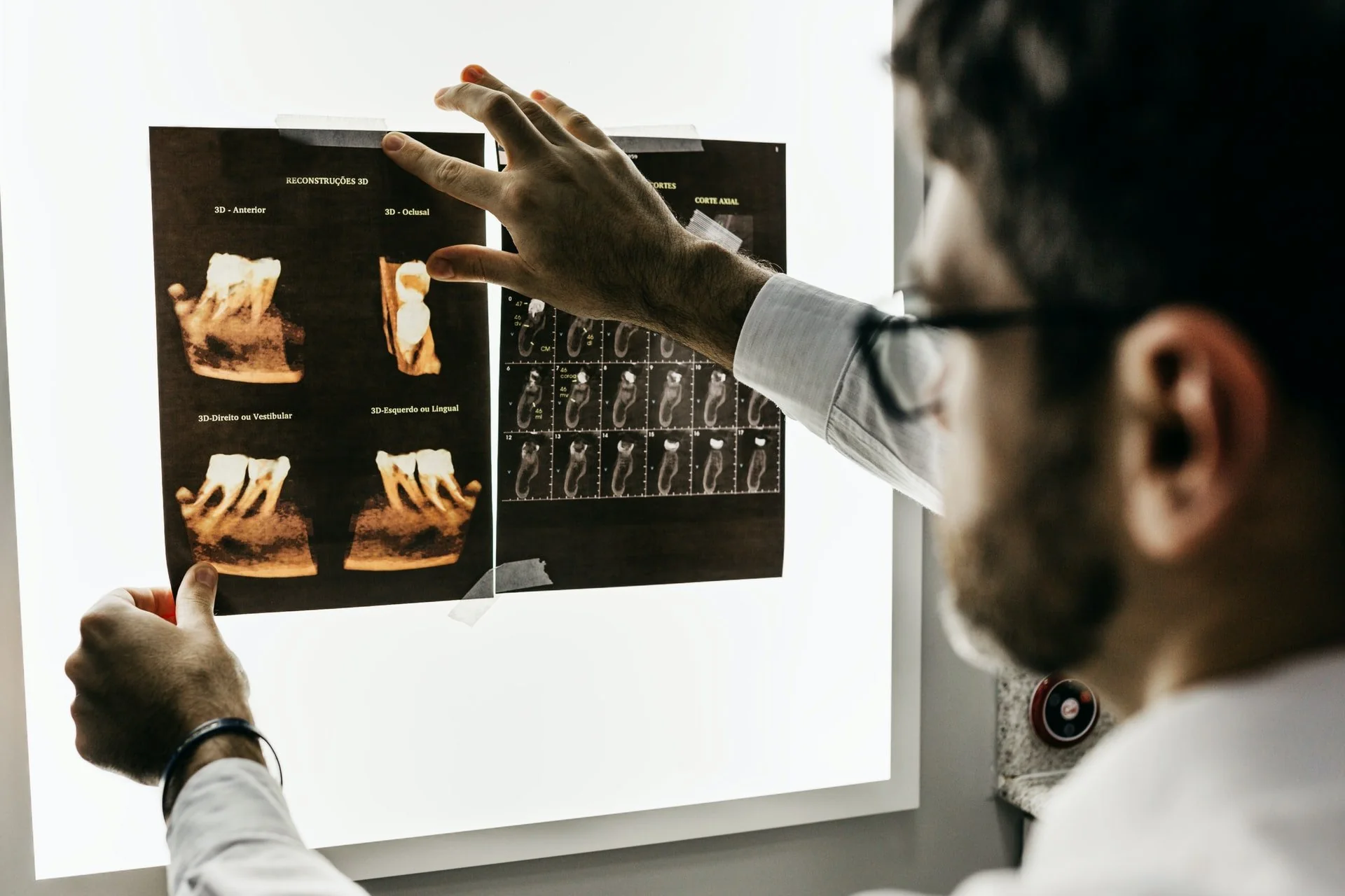 Higiena po wszczepieniu implantów
