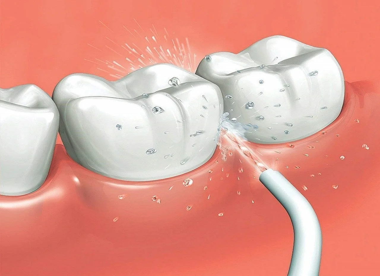 Irygator do zębów – stacjonarny czy bezprzewodowy? Który irygator dentystyczny warto wybrać?