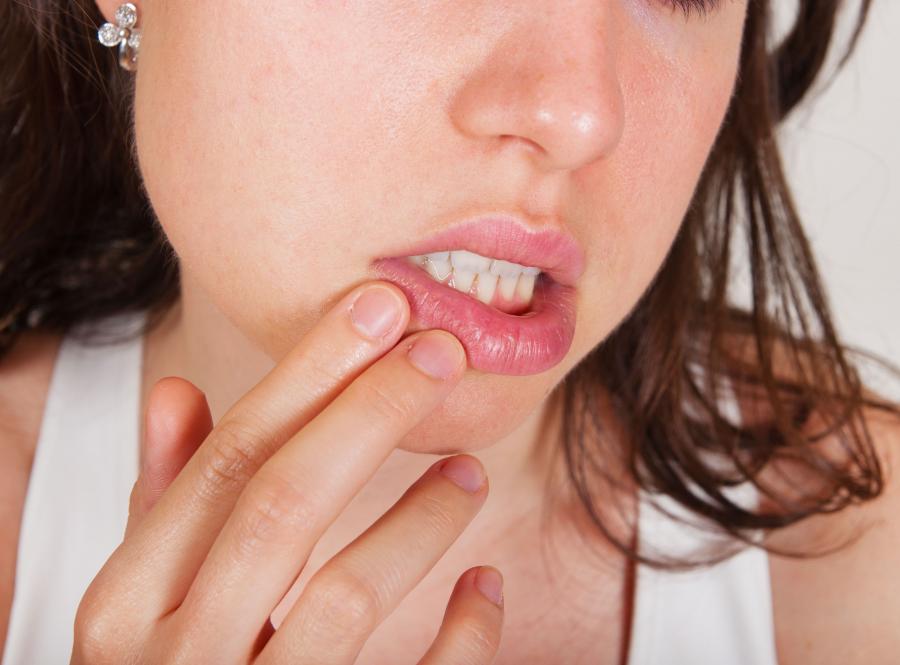 poparzenia jamy ustnej