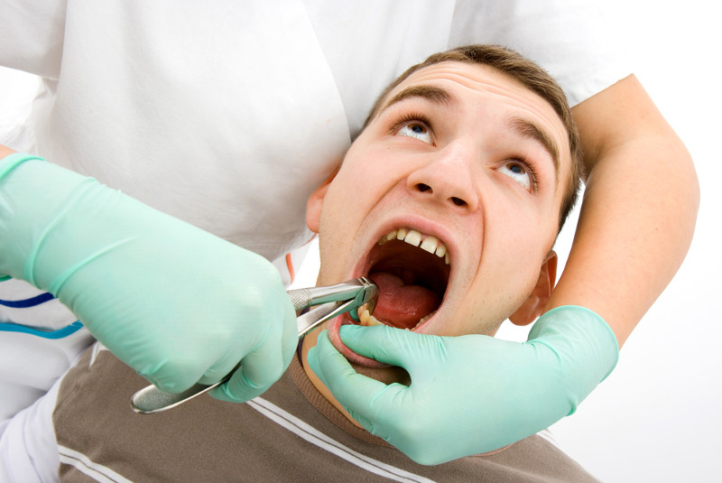 Zalecenia po usunięciu zęba. Sprawdź, jakie są powikłania i zalecenia po zabiegu ekstrakcji zęba!