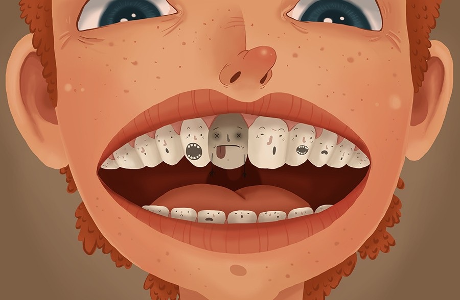 Złamany lub ukruszony ząb – co robić? Przyczyny ukruszeń i złamań zębów