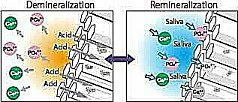 remineralizacja-szkliwa-denthelp-pl