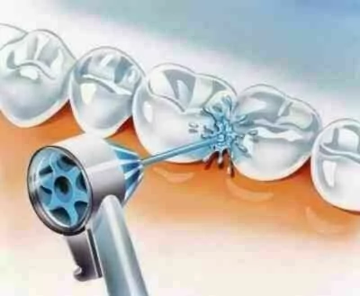 jak dziala irygator oralb dzialanie irygatora oral-b