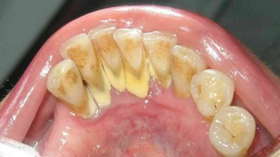 kamien na zebach kamien nazebny