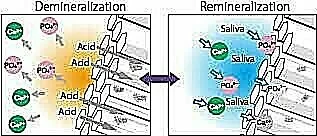 szkliwo remineralizacja